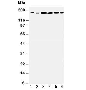 Western blot testing of Laminin gamma 1 antibody and Lane 1: rat kidney; 2: rat lung; 3: U87; 4: SMMC-7721; 5: HeLa; 6: SKOV3 cell lysate~