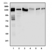 Western blot testing of 1) human A431, 2) human Caco-2, 3) human PC-3, 4) human A549, 5) rat lung and 6) mouse lung tissue lysate. Expected molecular weight: 130-140 kDa.