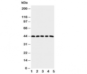 Western blot testing of PGE Receptor antibody and Lane 1:  HeLa;  2: A549;  3: MCF-7;  4: MM231;  5: MM453 cell lysate