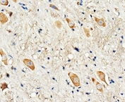 IHC-P: Dopamine Receptor D3 antibody testing of rat brain tissue