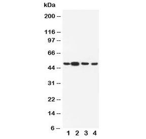 Western blot testing of Dopamine Receptor D3 antibody and Lane 1: rat testis; 2: rat brain; 3: U87; 4: HeLa cell lysate~