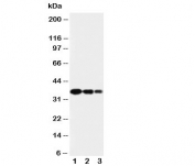 Western blot testing of SPARC antibody and Lane 1:  recombinant human protein 10ng;  2: 5ng;  3: 2.5ng