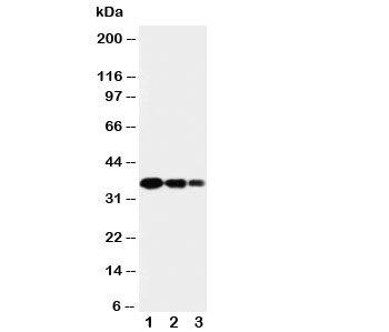 Western blot testing of SPARC antibody and Lane 1: recombinant human protein 10ng; 2: 5ng; 3: 2.5ng