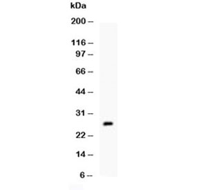 Western blot testing of recombinant mouse Trem1 protein (1ng/lane).