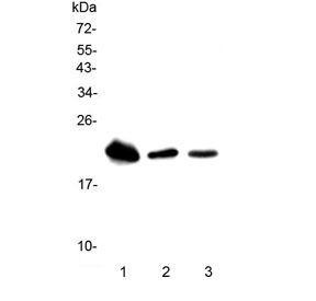 Western blot testing of 1) rat liver, 2) mouse liver and 3) mouse spleen lysate with Trem1 antibody. Predicted molecular weight ~26 kDa.