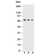 Western blot testing of Trem1 antibody and Lane 1:  recombinant mouse protein 10ng;  2: 5ng;  3: 2.5ng. The chimeric recombinant protein used for this test contains AA 21-202 + human Fc and is glycosylated.