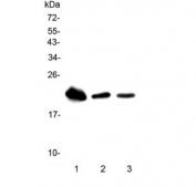 Western blot testing of 1) rat liver, 2) mouse liver and 3) mouse spleen lysate with Trem1 antibody. Predicted molecular weight ~26 kDa.