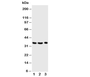 Western blot testing of Granzyme A antibody and Lane 1: Jurkat; 2: CEM; 3: Raji cell lysate~