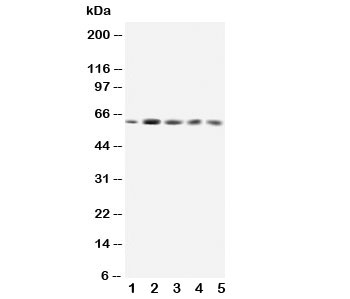 Western blot testing of GRB7 antibody and Lane 1: rat testis; 2: SMMC-7721; 3: HeLa; 4: A549; 5: SW620; Predicted size: 60KD; Observed size: 60KD~