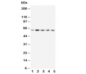Western blot testing of GRB7 antibody and Lane 1:  rat testis;  2: SMMC-7721;  3: HeLa;  4: A549;  5: SW620;  Predicted/observed molecular weight: 60kDa.