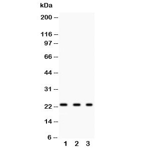 Western blot testing of GST pi antibody and Lane 1: rat kidney; 2: HeLa; 3: COLO320; Predicted size: 23KD; Observed size: 23KD~