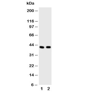 Western blot testing of HDAC8 antibody and Lane 1: rat heart; 2: human A549 cell lysate~