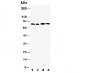 Western blot testing of CD168 antibody and Lane 1:  MM231;  2: MM453;  3: HeLa;  4: A549 cell lysate. Expected molecular weight ~72 kDa (cell surface form) and 85-95 kDa (intracellular form).