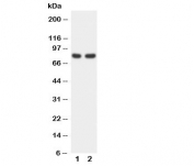 Western blot testing of FOXP1 antibody and Lane 1:  rat spleen;  2: COLO320 cell lysate. Predicted/observed molecular weight: ~75 kDa.