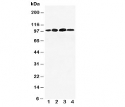 Western blot testing of Mineralocorticoid Receptor antibody and Lane 1:  293T;  2: SMMC-7721;  3: SW620;  4: HeLa cell lysate. Expected molecular weight ~107/108/94 kDa (isoforms 1/3/4).