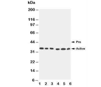 Western blot testing of Caspase-9 antibody and Lane 1: SMMC-7721; 2: MCF-7; 3: CEM; 4: Jurkat; 5: Raji; 6: HeLa~