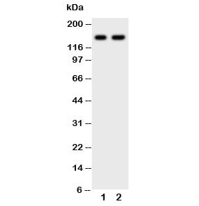 Western blot testing of anti-CD45 antibody and Lane 1: Jurkat; 2: CEM; Predicted size: 147KD; Observed size: 147KD