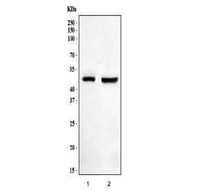 Western blot testing of human 1) placenta and 2) HepG2 cell lysate with Haptoglobin antibody. Predicted molecular weight: 35-40 kDa (beta chain), 45-50 kDa (alpha + beta chain).
