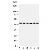Western blot testing of HDAC3 antibody and Lane 1:  rat stomach;  2: rat testis;  3: MCF-7;  4: HeLa;  5: Jurkat;  6: SKOV cell lysate. Predicted molecular weight ~49 kDa.