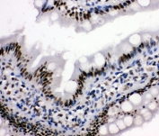 IHC-P: HDAC3 antibody testing of rat intestine tissue.