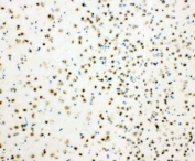 IHC-F testing of mouse brain tissue.