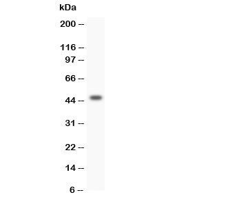 Western blot testing of HOXA3 antibody and SW620 lysate; Predicted size: 46KD; Observed size: 46KD