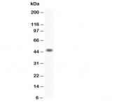 Western blot testing of human SW620 cell lysate with HOXA3 antibody. Predicted molecular weight ~46 kDa.