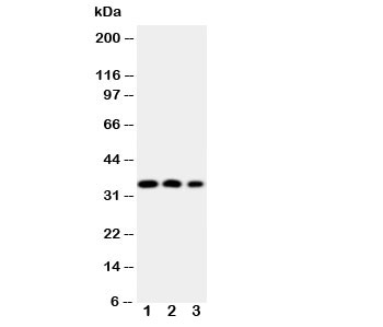 Western blot testing of HOXA4 antibody and Lane 1: SW620; 2: SW620; 3: PC-12 cell Nuclear lysate