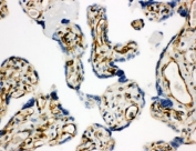IHC-P: HSD17B2 antibody testing of human placenta tissue