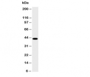 Western blot testing of HSD17B2 antibody and human placenta lysate;  Predicted size: 43KD;  Observed size: 43KD