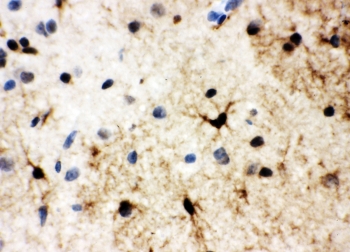 IHC testing of FFPE rat brain tissue with HSF2 antibody at 1ug/ml. Required HIER: steam section in pH6 citrate buffer for 20 min and allow to cool prior to testing.