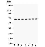 Western blot testing of HSF2 antibody and Lane 1:  rat kidney;  2: rat spleen;  3: human 293T;  4: (h) MCF-7;  5: (h) Jurkat;  6: (h) A549;  7: (h) CEM lysate; Predicted molecular weight ~60 kDa.