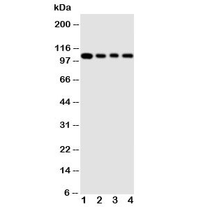 Western blot testing of HSP105 antibody and Lane 1: rat ovary ; 2: A549 cell lysate; 3: U87 cell lysate; 4: HeLa cell lysate