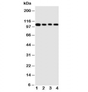 Western blot testing of HSP105 antibody and Lane 1:  rat ovary ;  2: A549 cell  lysate;  3: U87 cell  lysate;  4: HeLa cell  lysate. Expected molecular weight: 105-110 kDa.
