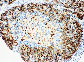 IHC-P: HSD17B1 antibody testing of rat ovary tissue
