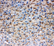 IHC-P testing of rat liver tissue with HSD17B1 antibody. Required HIER: steam section in pH6 citrate buffer for 20 min.