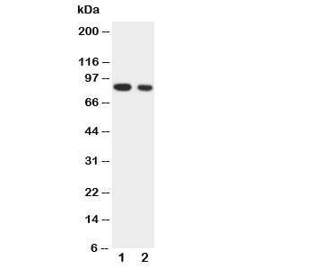 Western blot testing of IKKa antibody and Lane 1: HeLa; 2: Jurkat cell lysate