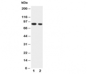 Western blot testing of IKKa antibody and Lane 1:  HeLa;  2: Jurkat cell lysate. Predicted molecular weight: ~85kDa.