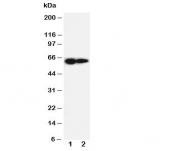 Western blot testing of IL-2 Receptor antibody and Lane 1:  PANC cell lysate ;  2: HeLa cell lysate.  Expected molecular weight ~61 kDa (unmodified), 70-75 kDa (glycosylated).