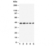 Western blot testing of IL-2 Receptor antibody and Lane 1:  PANC;  2: HeLa;  3: Jurkat;  4: Raji;  5: CEM cell lysate.  Expected size: 42KD