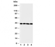Western blot testing of IL3RA antibody and Lane 1:  A431 cell lysate ;  2: SMMC-7721;  3: U87;  4: 293T cell lysate. Predicted molecular weight ~43kDa.