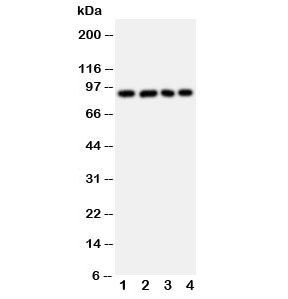 Western blot testing of IL4R antibody and Lane 1: A431; 2: SMMC-7721; 3: U87; 4: 293T cell lysate. Expected size: 90KD~
