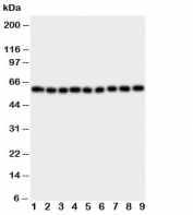 Western blot testing of IL5RA antibody and Lane 1:  A549;  2: SMMC-7721;  3: U87;  4: 293T;  5: PANC;  6: HeLa;  7: Jurkat;  8: Raji;  9: CEM cell lysate.  The 420 amino acid protein is routinely visualized between 46~60KD, depending on level of glycosylation.