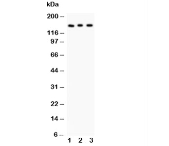 Western blot testing of Insulin Receptor antibody and Lane 1: rat kidney; 2: PANC; 3: HeLa