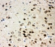 IHC-P: Integrin alpha 3 antibody testing of rat brain tissue. HIER: steamed with pH6 citrate buffer.