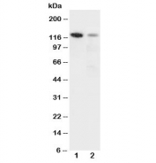 Western blot testing of Integrin alpha 3 antibody and Lane 1:  rat heart;  2: HeLa cell lysate.  Expected molecular weight: 119-150 kDa depending on glycosylation level.