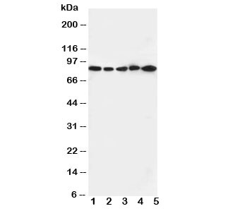 Western blot testing of CD18 antibody and Lane 1: Jurkat cell lysate ; 2: CEM; 3: HT1080; 4: SMMC-7721; 5: HeLa cell lysate. Predicted/Observed size: 85~95KD depending on glycosylation level~