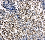 IHC-P: KIM-1 antibody testing of human tonsil tissue. HIER: steamed with pH6 citrate buffer.