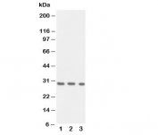 Western blot testing of Kallikrein-1 antibody and Lane 1:  recombinant human protein 10ng;  2: 5ng;  3: 2.5ng