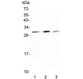 Western blot testing of Kallikrein-2 antibody and Lane 1: PANC; 2: HeLa; 3: 293T cell lysate. Predicted molecular weight ~17-29 kDa (multiple isoforms).~